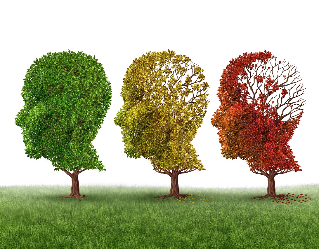 Memory,Loss,And,Brain,Aging,Due,To,Dementia,And,Alzheimer's